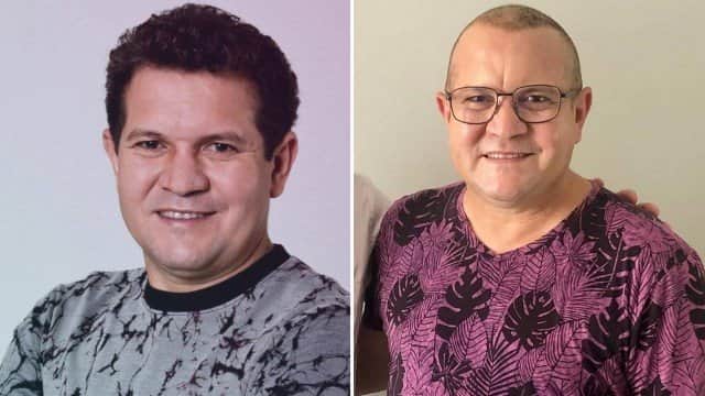 Ximbinha decide se submeter a um implante capilar (Imagem: reprodução) Ximbinha decide se submeter a um implante capilar (Imagem: reprodução)