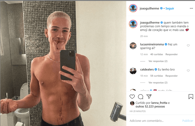 João Guilherme roubou a cena e preocupou fãs com o nariz sangrando (Foto: Reprodução / Instagram) leoardo ze felipe João Guilherme roubou a cena e preocupou fãs com o nariz sangrando (Foto: Reprodução / Instagram) leoardo ze felipe