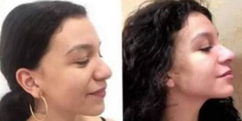 Cantora Priscilla Alcântara exibindo o seu antes e depois (Foto: Montagem) Cantora Priscilla Alcântara exibindo o seu antes e depois (Foto: Montagem)