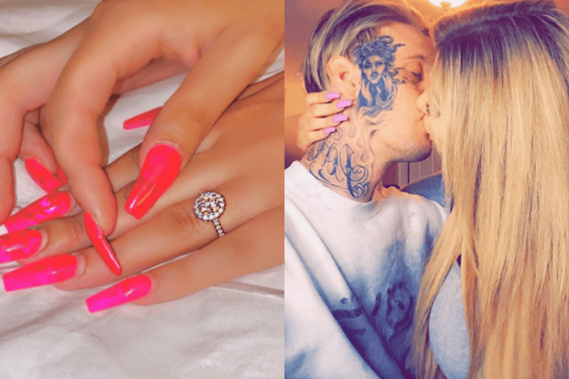 Aaron Carter, após ser agredido por namorada, guerra ser criada e ela ser presa, anuncia casamento com companheira (Foto: Reprodução) Aaron Carter, após ser agredido por namorada, guerra ser criada e ela ser presa, anuncia casamento com companheira (Foto: Reprodução)