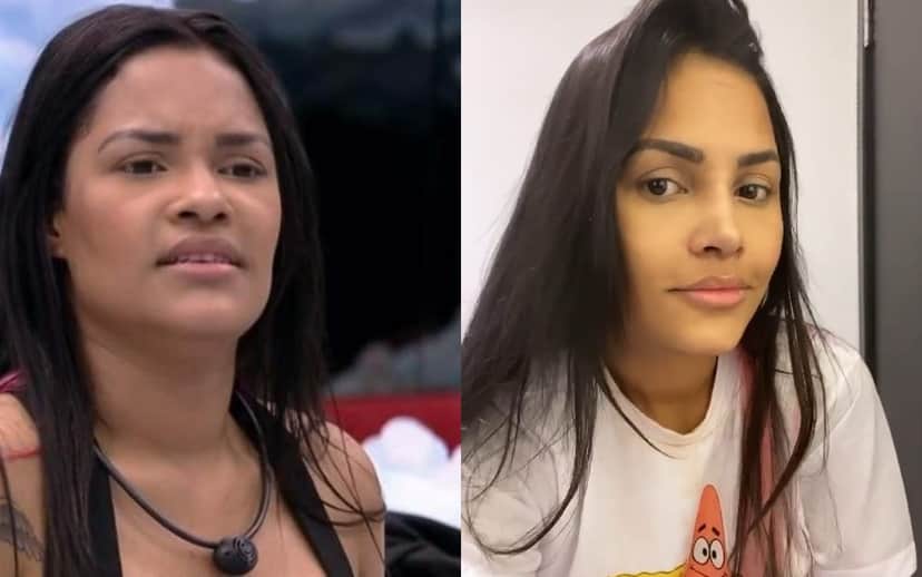 Antes e depois da rinoplastia e harmonização facial de Flayslane (Foto: reprodução) Antes e depois da rinoplastia e harmonização facial de Flayslane (Foto: reprodução)
