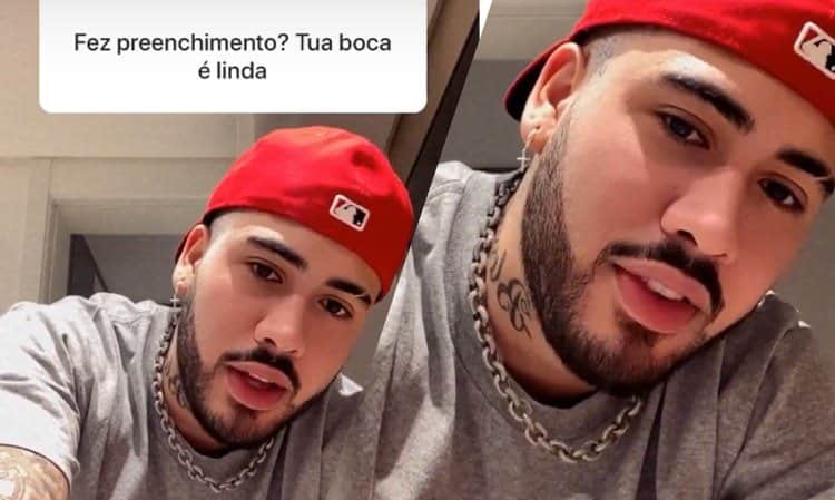 Kevinho disse que sua boca carnuda não é procedimento estético, "é natural! (Montagem: TV Foco) Kevinho disse que sua boca carnuda não é procedimento estético, "é natural! (Montagem: TV Foco)