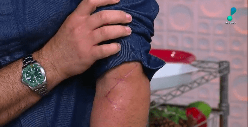 Edu Guedes acabou expondo cicatriz após acidente (Foto montagem) 