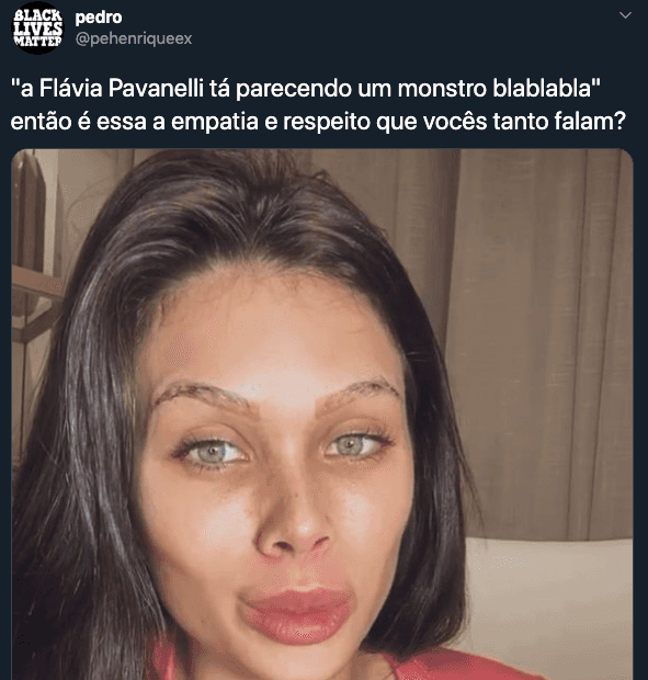 Flávia Pavanelli foi duramente criticada pelos procedimentos estéticos (Foto: reprodução/Twitter) Flávia Pavanelli foi duramente criticada pelos procedimentos estéticos (Foto: reprodução/Twitter)