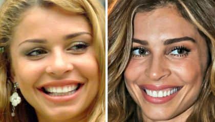 Grazi Massafera com e sem lentes nos dentes Grazi Massafera com e sem lentes nos dentes