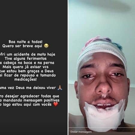 MC Brinquedo se manifestou nas redes sociais após acidente (Foto: Montagem) MC Brinquedo se manifestou nas redes sociais após acidente (Foto: Montagem)
