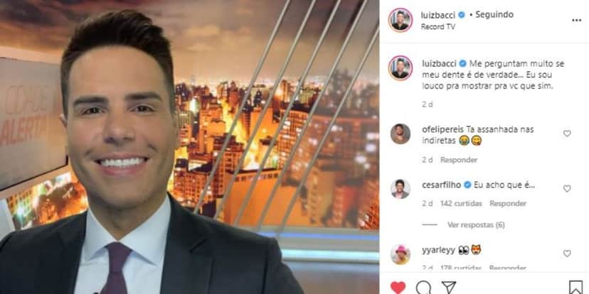 Luiz Bacci fez revelação sobre os seus dentes branquinhos (Foto: Reprodução/Instagram) Luiz Bacci fez revelação sobre os seus dentes branquinhos (Foto: Reprodução/Instagram)