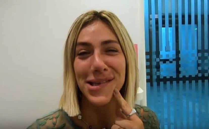 A esposa de Bruno Gagliasso confessou que ficou com o rosto torto após levar uma anestesia no dentista (Foto: Reprodução) A esposa de Bruno Gagliasso confessou que ficou com o rosto torto após levar uma anestesia no dentista (Foto: Reprodução)