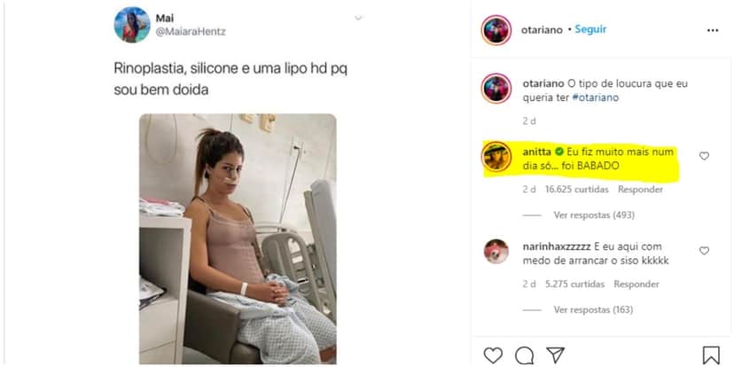 Anitta fala que fez mais de 3 plásticas em um só dia (Foto: Reprodução) Anitta fala que fez mais de 3 plásticas em um só dia (Foto: Reprodução)
