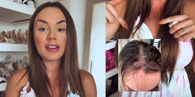 Apresentadora Juju Salimeni mostra foto do cabelo quando descobriu depressão (Foto: Reprodução/Instagram) Apresentadora Juju Salimeni mostra foto do cabelo quando descobriu depressão (Foto: Reprodução/Instagram)