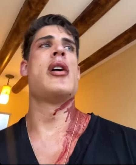 Tiago Ramos surgiu com o corpo todo sujo de sangue (Foto: Reprodução/ Instagram) Tiago Ramos surgiu com o corpo todo sujo de sangue (Foto: Reprodução/ Instagram)