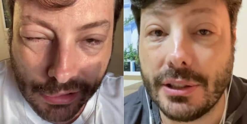 Danilo Gentili surgiu com rosto deformado na web (Imagem: Montagem) Danilo Gentili surgiu com rosto deformado na web (Imagem: Montagem)