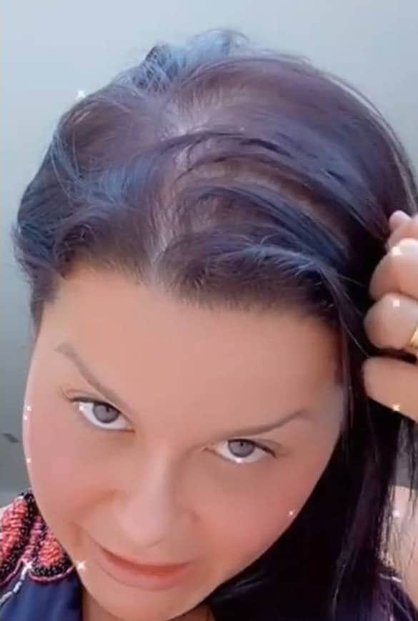 Maraisa conta de seu problema de saúde (Foto: Reprodução/Instagram) Maraisa conta de seu problema de saúde (Foto: Reprodução/Instagram)
