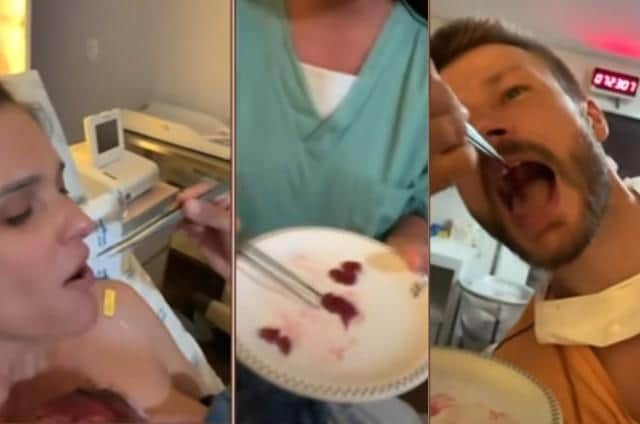 Fernanda Lima e Rodrigo Hilbert comendo placenta Fernanda Lima e Rodrigo Hilbert comendo placenta
