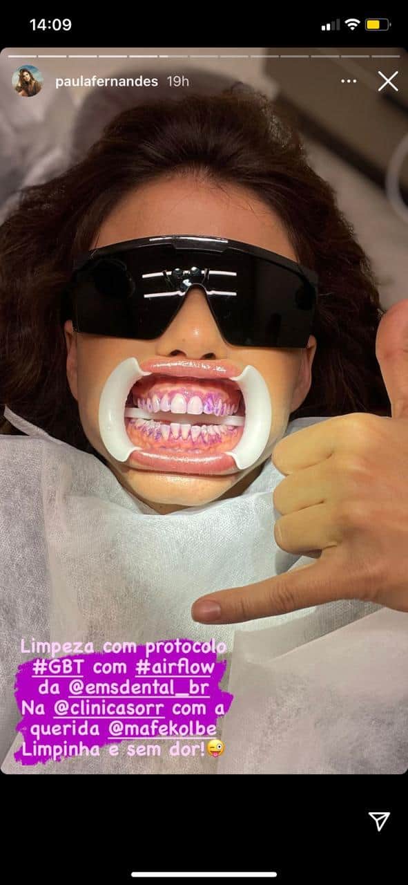 Paula Fernandes surge em maca de dentista com aparelho em sua boca (Reprodução) Paula Fernandes surge em maca de dentista com aparelho em sua boca (Reprodução)