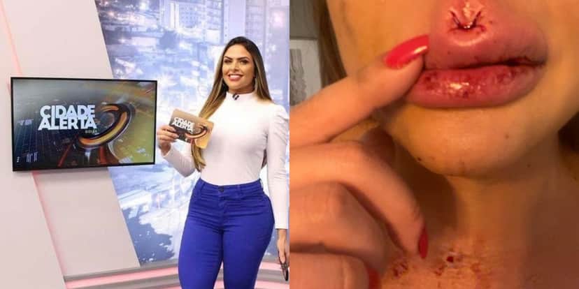 Apresentadora da Record expõe agressão do ex (Foto: Reprodução) Apresentadora da Record expõe agressão do ex (Foto: Reprodução)