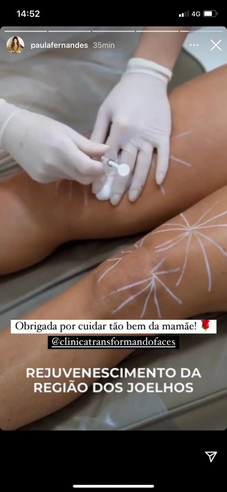 De acordo com cantora, mãe passou por processo clinico (Reprodução) De acordo com cantora, mãe passou por processo clinico (Reprodução)