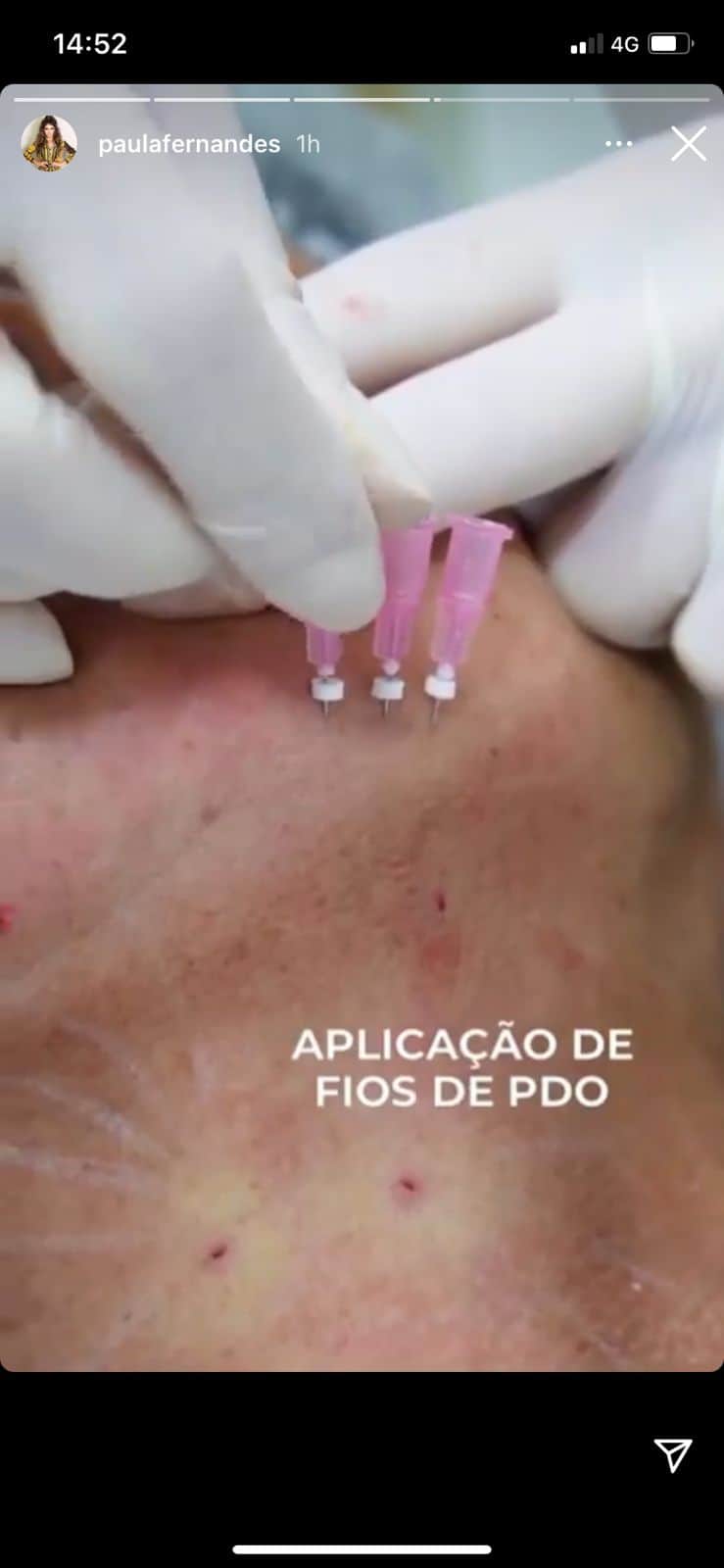 Paula Fernandes expõe mãe em clínica (Reprodução) Paula Fernandes expõe mãe em clínica (Reprodução)