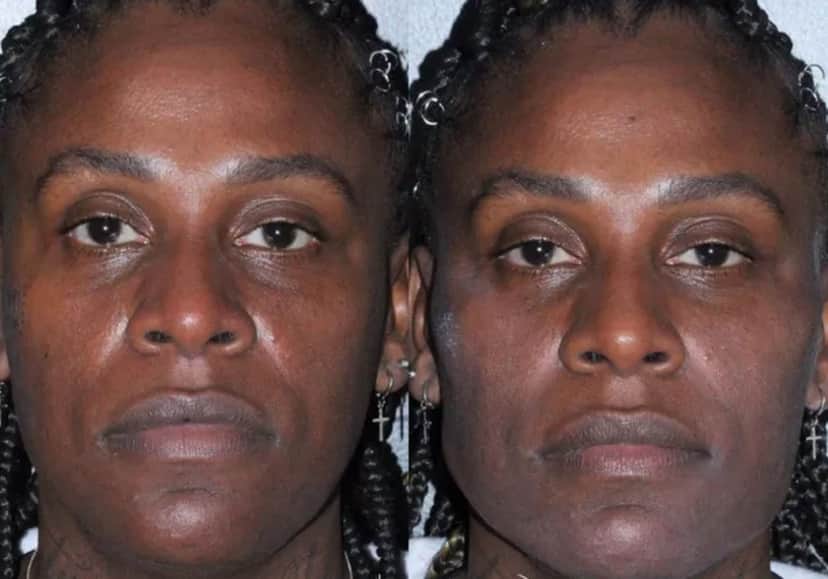 Pepê e Neném fazem harmonização facial (Reprodução) Pepê e Neném fazem harmonização facial (Reprodução)