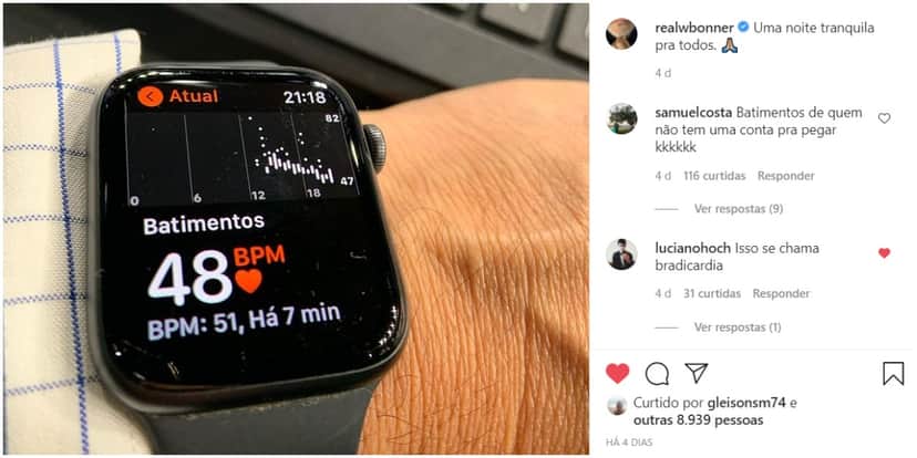 Apple Watch de William Bonner causou discussões - Foto: Reprodução Apple Watch de William Bonner causou discussões - Foto: Reprodução