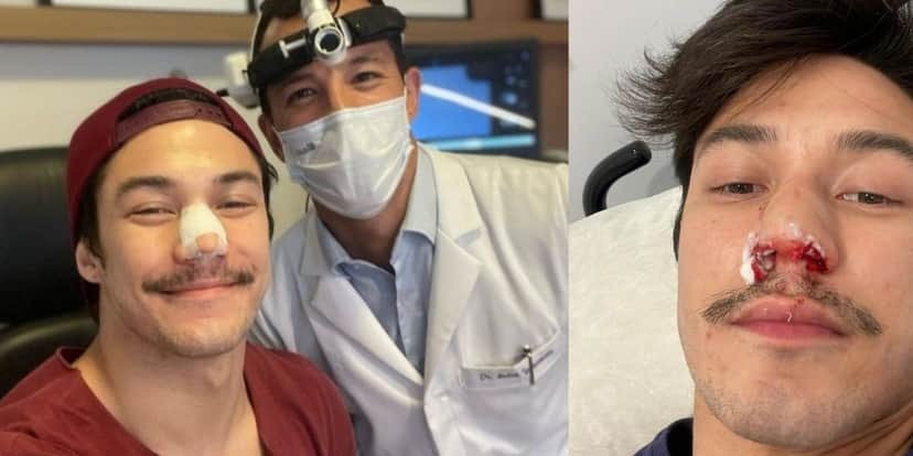 Arthur Nory Arthur Nory