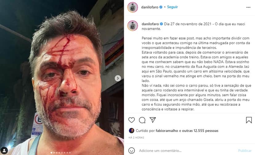 Irmão de Rodrigo Faro surgiu com o rosto coberto por sangue (Foto: Reprodução) Irmão de Rodrigo Faro surgiu com o rosto coberto por sangue (Foto: Reprodução)
