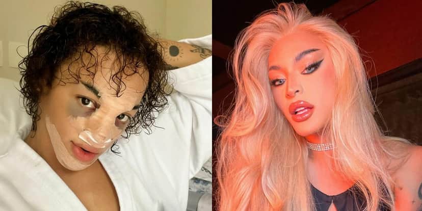 Pabllo Vittar se rendeu a uma cirurgia no nariz (Foto: Reprodução) Pabllo Vittar se rendeu a uma cirurgia no nariz (Foto: Reprodução)