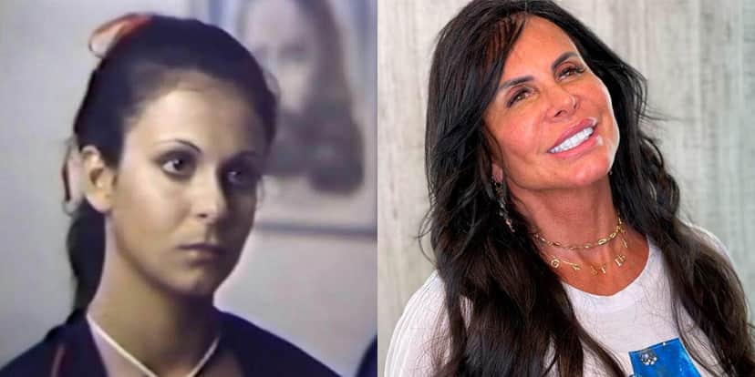 Gretchen antes e depois dos procedimentos estéticos (Foto: Reprodução/Instagram) Gretchen antes e depois dos procedimentos estéticos (Foto: Reprodução/Instagram)