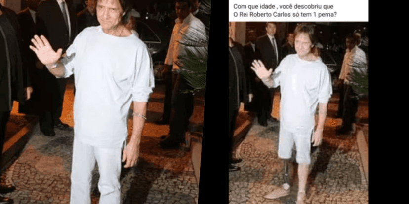 Roberto Carlos teve suposta foto no passado divulgada com prótese na perna direita (Foto montagem: TV Foco) Roberto Carlos teve suposta foto no passado divulgada com prótese na perna direita (Foto montagem: TV Foco)