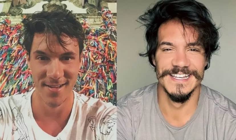Eliezer do BBB22, antes e depois da harmonização facial (Foto: Reprodução / Instagram) Eliezer do BBB22, antes e depois da harmonização facial (Foto: Reprodução / Instagram)