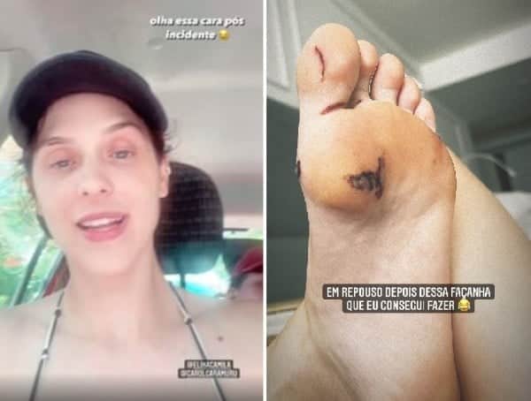Sophia Abrahão cortou o pé e fez relato nas redes sociais (Imagem: Montagem)