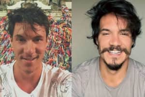 Veja o antes e o depois do procedimento estético de Eliezer para entrar no BBB22 (Foto: Reprodução / Internet) Veja o antes e o depois do procedimento estético de Eliezer para entrar no BBB22 (Foto: Reprodução / Internet)