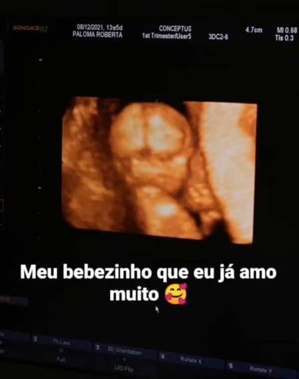 MC Loma exibiu ultrassom do filho nas redes sociais (Imagem: Reprodução) MC Loma exibiu ultrassom do filho nas redes sociais (Imagem: Reprodução)