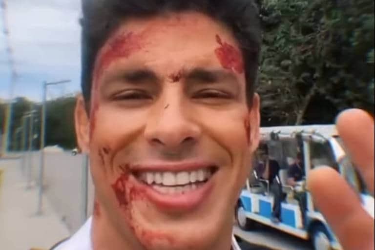 Cauã Reymond surge com rosto ensanguentado e expõe o que aconteceu na Globo: "É por isso que estou assim" Cauã Reymond surge com rosto ensanguentado e expõe o que aconteceu na Globo: "É por isso que estou assim"