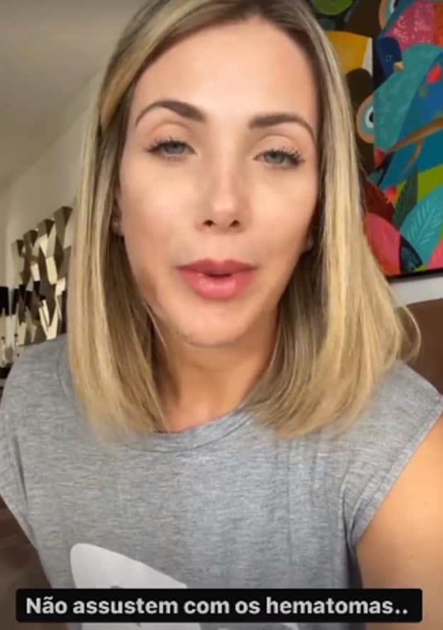 Érica Reis usa suas redes sociais para publicar vídeos explicando sobre o ataque e as consequências (Reprodução/ Instagram) Érica Reis usa suas redes sociais para publicar vídeos explicando sobre o ataque e as consequências (Reprodução/ Instagram)