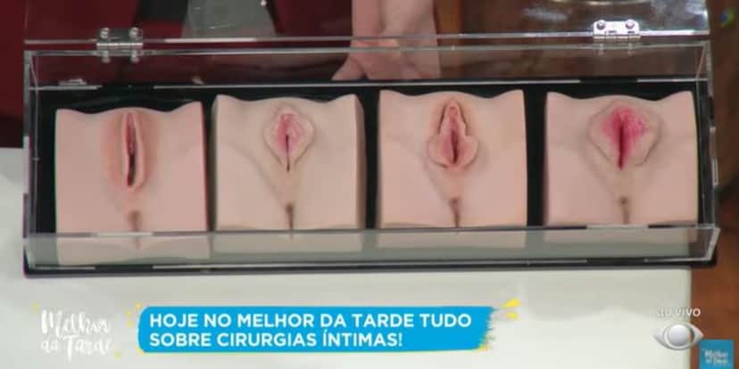 Ginecologista deu informações sobre cirurgia íntima (Foto: Reprodução/Band) Ginecologista deu informações sobre cirurgia íntima (Foto: Reprodução/Band)