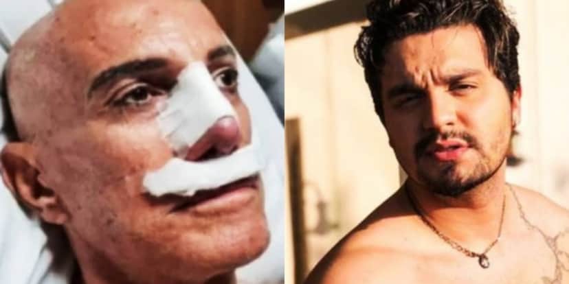 Amin Khader surgiu com rosto enfaixado após cirurgia para ficar com nariz igual ao de Luan Santana (Imagem: Montagem) Amin Khader surgiu com rosto enfaixado após cirurgia para ficar com nariz igual ao de Luan Santana (Imagem: Montagem)