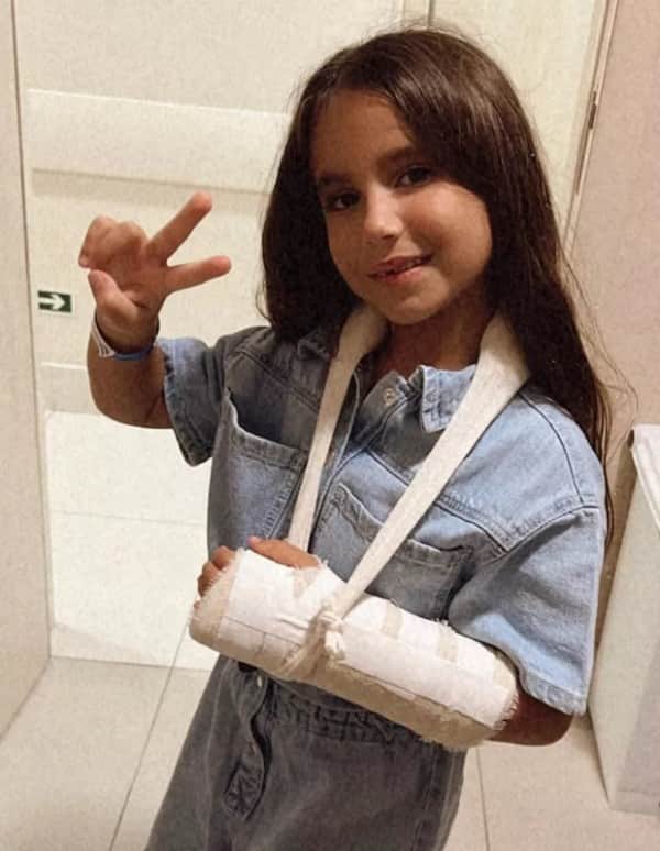 Maria Flor exibindo o seu braço fraturado em foto (Imagem: Reprodução) Maria Flor exibindo o seu braço fraturado em foto (Imagem: Reprodução)