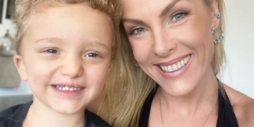 Ana Hickmann mostra antes e depois do sobrinho que nasceu com lábio leporino - Foto: Reprodução Instagram Ana Hickmann mostra antes e depois do sobrinho que nasceu com lábio leporino - Foto: Reprodução Instagram