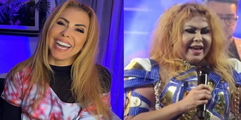 Joelma com rosto inchado (Foto: Montagem) Joelma com rosto inchado (Foto: Montagem)