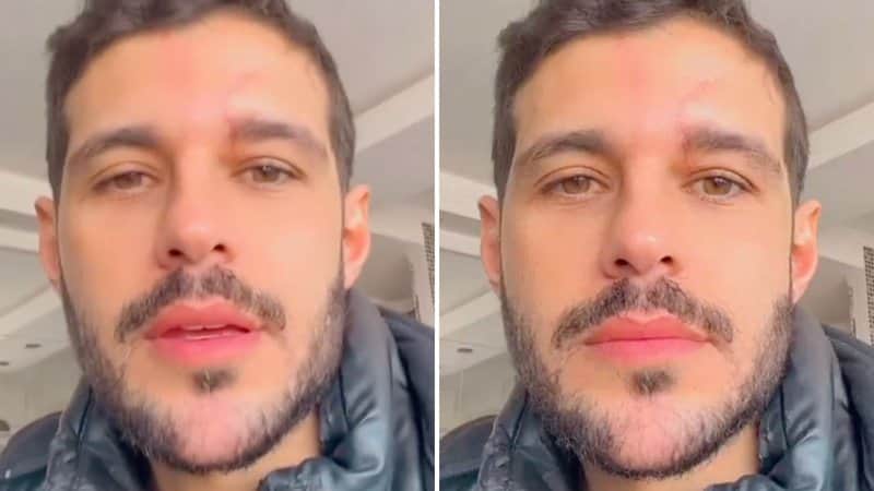 Rodrigo Mussi contou sobre seu estado de saude (Foto: Reprodução/ Instagram) Rodrigo Mussi contou sobre seu estado de saude (Foto: Reprodução/ Instagram)
