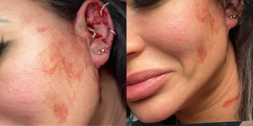 Milena Lins fez vídeos no Instagram para desabafar sobre relacionamento abusivo - Reprodução Instagram Milena Lins fez vídeos no Instagram para desabafar sobre relacionamento abusivo - Reprodução Instagram