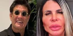 Sérgio Mallandro fica idêntico a Gretchen, segundo internautas, após procedimento no rosto e surge irreconhecível