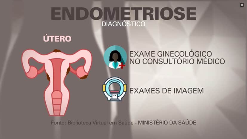 "Fantástico" explica doença de Anitta e alerta mulheres "Fantástico" explica doença de Anitta e alerta mulheres