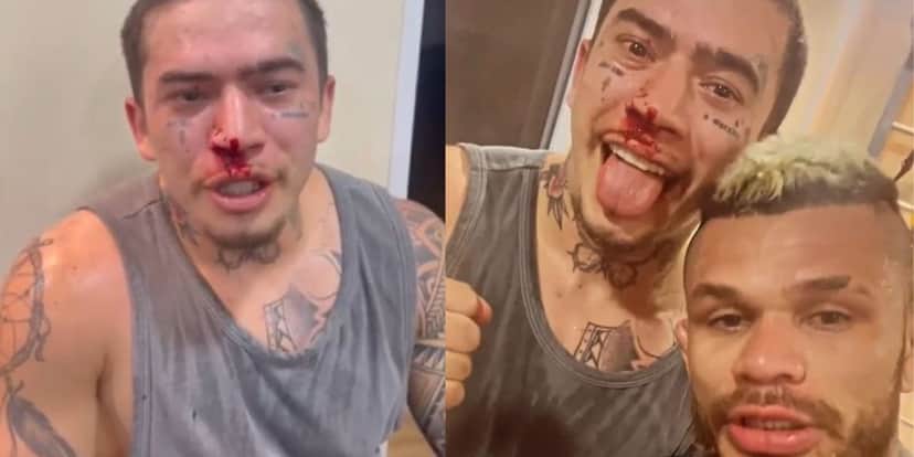 Whindersson Nunes surge com ferimentos e explica que levou a pior durante luta - Reprodução Instagram Whindersson Nunes surge com ferimentos e explica que levou a pior durante luta - Reprodução Instagram