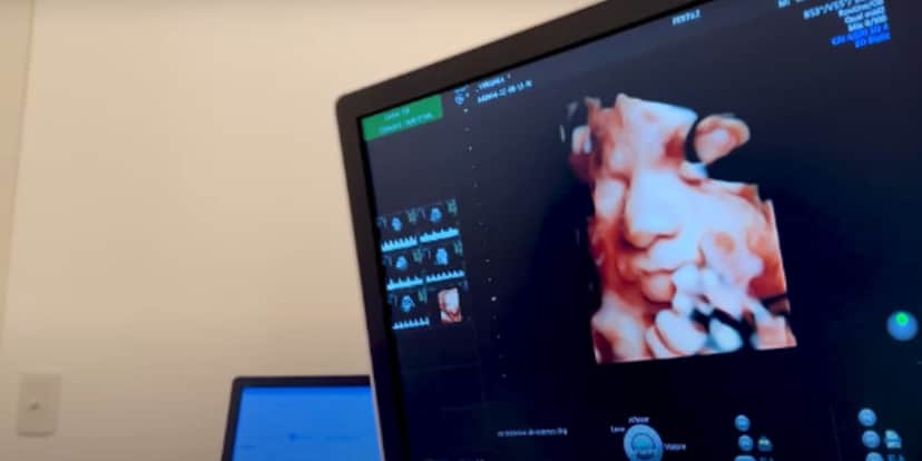 Virgínia Fonseca mostra pela primeira vez o rostinho de sua caçula em ultrassom 3D Virgínia Fonseca mostra pela primeira vez o rostinho de sua caçula em ultrassom 3D