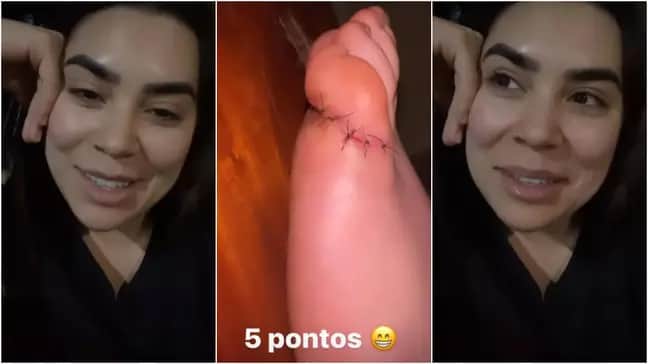 Naiara Azevedo machucou o pé ao pisar em cima de uma faca (Foto: Reprodução) Naiara Azevedo machucou o pé ao pisar em cima de uma faca (Foto: Reprodução)