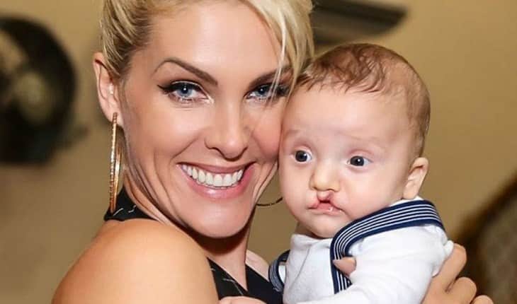 Ana Hickmann em foto com o sobrinho com lábios leopoldino (Foto: Reprodução) Ana Hickmann em foto com o sobrinho com lábios leopoldino (Foto: Reprodução)