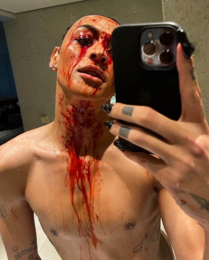 Pabllo Vittar surgiu ensaguentada e contou preocupação da mãe (Foto: Reprodução) Pabllo Vittar surgiu ensaguentada e contou preocupação da mãe (Foto: Reprodução)