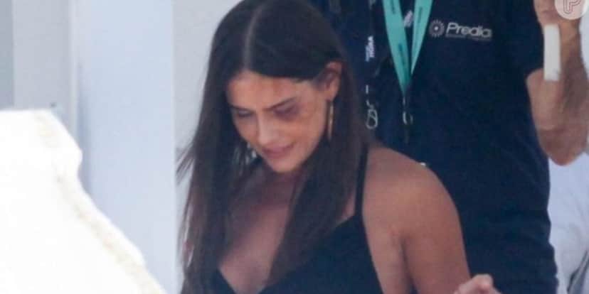 Deborah Secco assusta fãs ao aparecer toda machucada (Foto Reprodução/Internet) Deborah Secco assusta fãs ao aparecer toda machucada (Foto Reprodução/Internet)